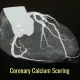 Evaluation du risque cardiovasculaire et score calcique bénéfice !